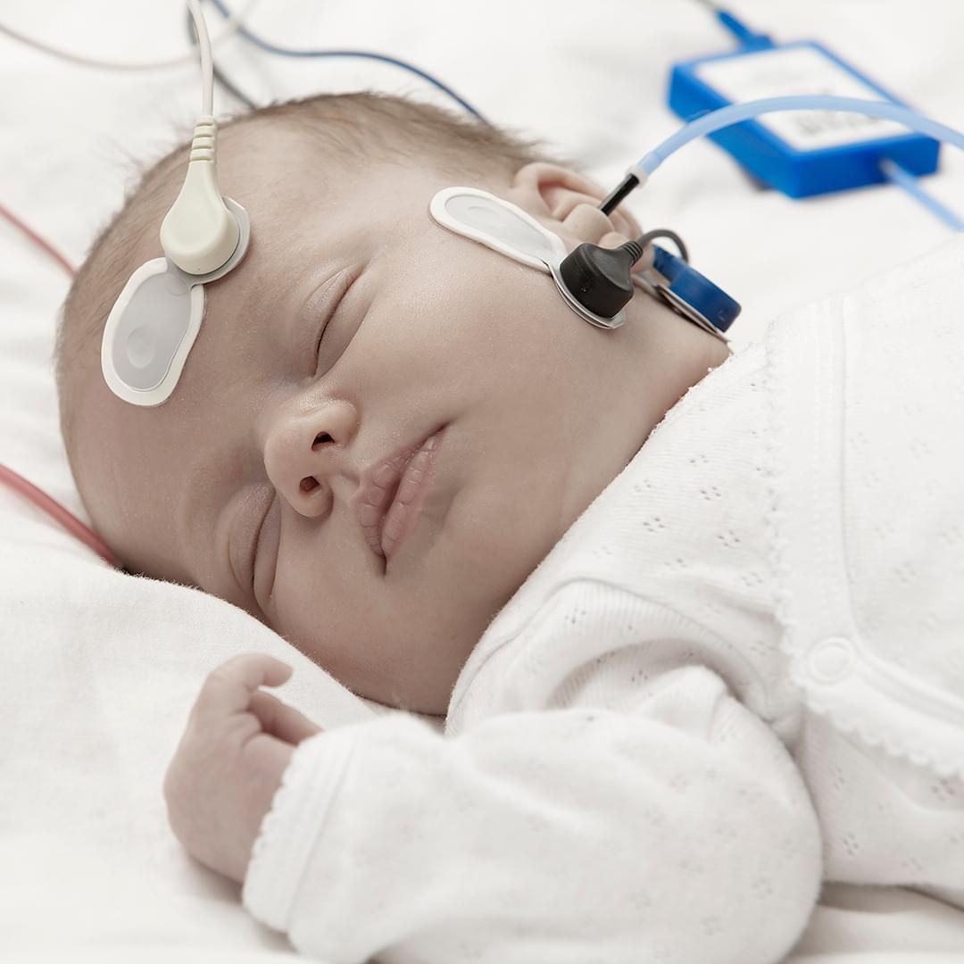 Newborn Hearing Assessment: Evoked Potentials Workshop